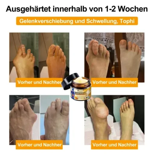 Aetheris™ Bienengift Sofortige Ultra Starke Schmerztherapie-Creme