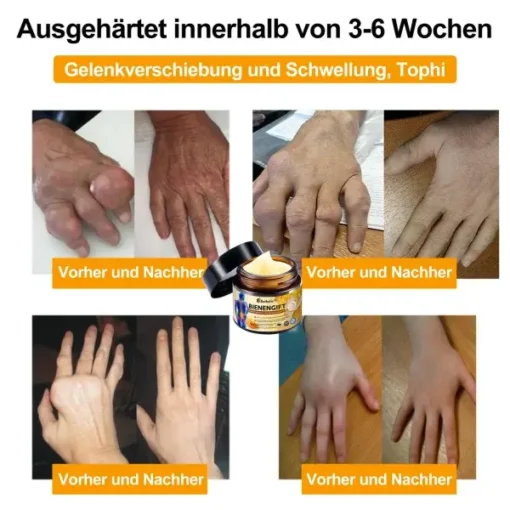 Aetheris™ Bienengift Sofortige Ultra Starke Schmerztherapie-Creme