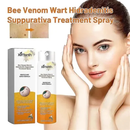 Bee Venom Wart Hidradenitis Suppurativa Treatment Spray