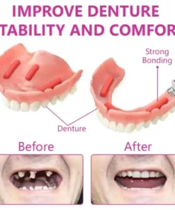 Ceoerty™ SureFit Thermal Denture Adhesive