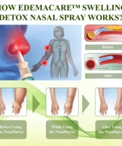 EdemaCare™ SwellingDetox Nasal Spray