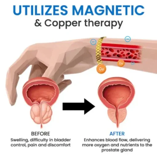 FLYCARE™ Magnetic Copper Prostate Boost Band