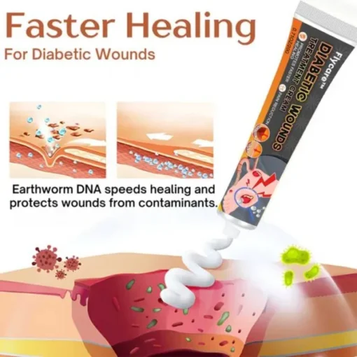 Flycare™ Diabetic Wound Intensive Treatment Cream