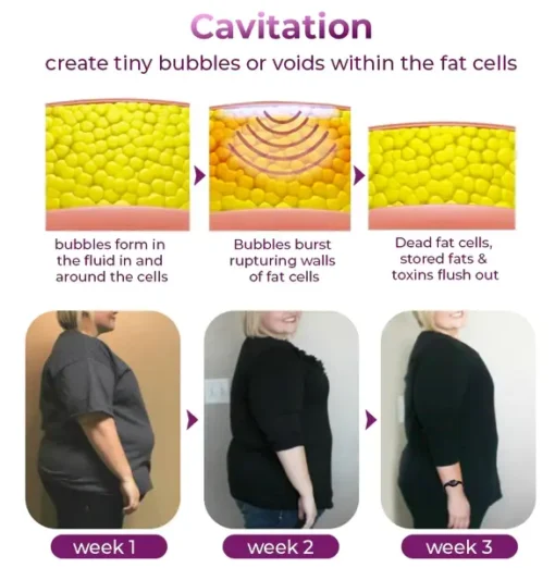 Futusly™ Ultrasonic Fat Removal and Detox Bracelet