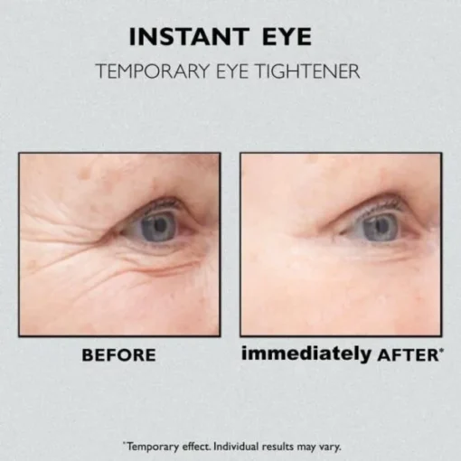 Lovilds™ Instant Eye Temporary Eye Lifter