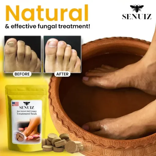 SENUIZ™ Bee Venom Nail Fungus Treatment Moisturizer