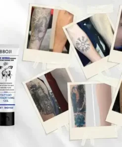 Tattoo Removal Cream - Fast Painless & Scar-Free Tattoo Erasure