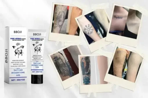 Tattoo Removal Cream - Fast Painless & Scar-Free Tattoo Erasure