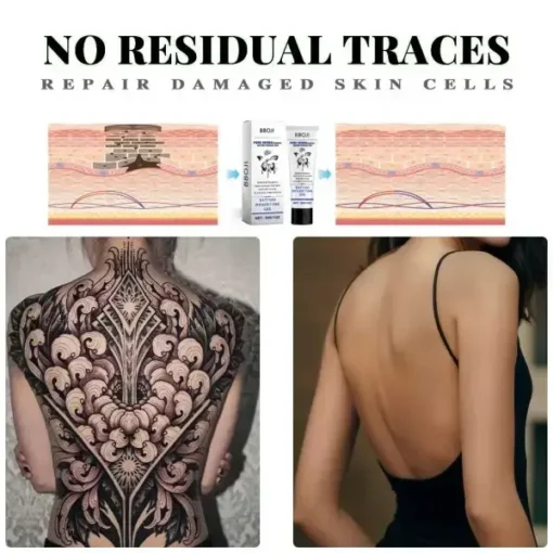 Tattoo Removal Cream - Fast Painless & Scar-Free Tattoo Erasure