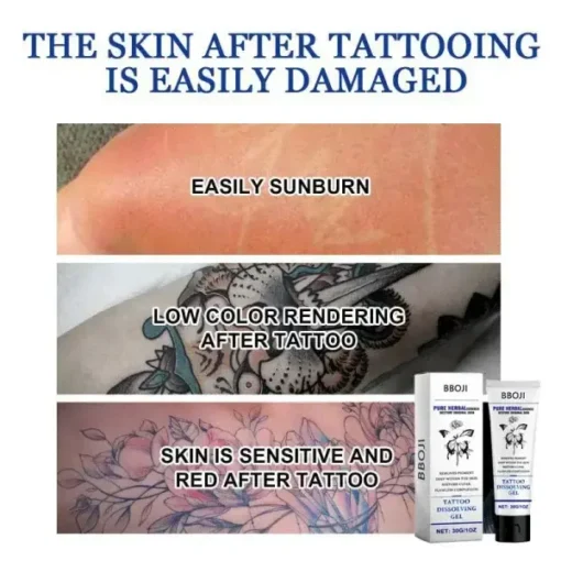 Tattoo Removal Cream - Fast Painless & Scar-Free Tattoo Erasure